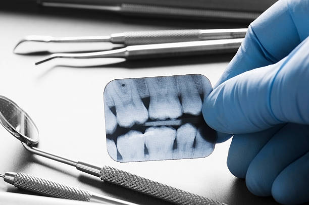 歯科医の手に持つ歯科 x 線手術用グローブ - 歯 写真 ストックフォトと画像