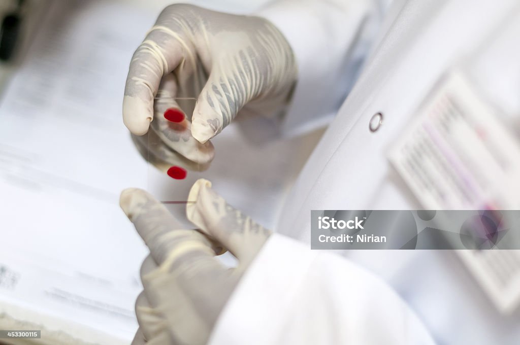 Bloodtest - Foto de stock de Hepatitis libre de derechos