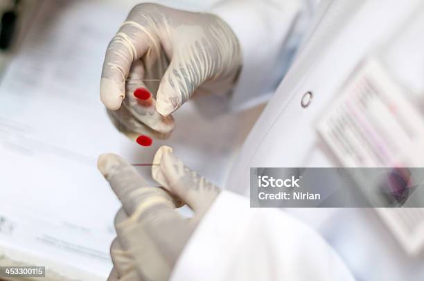 Bloodtest Foto de stock y más banco de imágenes de Hepatitis - Hepatitis, ADN, Analizar