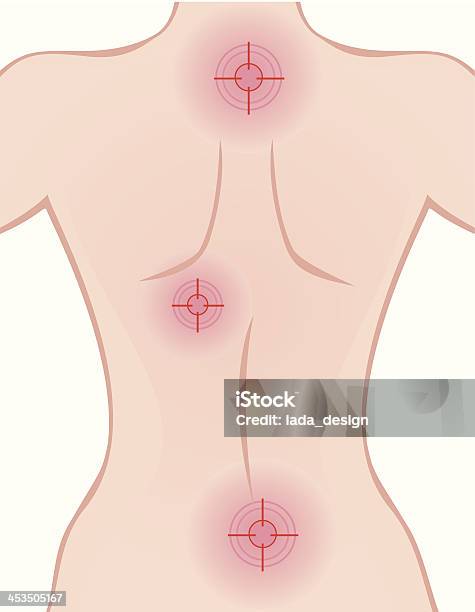 Боль В Спине Изображение Изолированные На Белом — стоковая векторная графика и другие изображения на тему Вид сзади - Вид сзади, Иллюстрация, Обнажённый