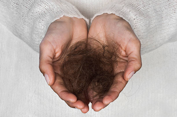 istock Woman losing hair 453671771
