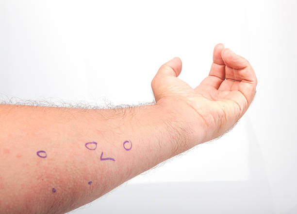 istock Red Skin Rash With Bumps. 453870299