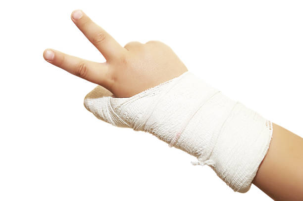gipsarm - crutch physical injury accident physical impairment fotografías e imágenes de stock