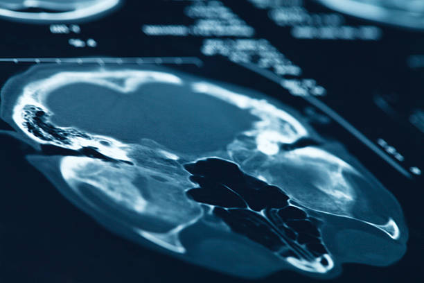 head x 線ます。 - brain mri scan alzheimers disease medical scan ストックフォトと画像