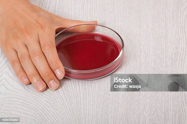 Foto de Sangue Em Pratos De Petri e mais fotos de stock de Analisar - Analisar, Bactéria, Biologia