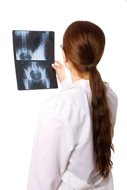 médica examinar um raio x do tórax - x ray image coccyx radiologist hip imagens e fotografias de stock