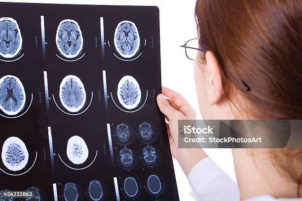 Kobieta Lekarz Badając Mózgu Tomografia Komputerowa - zdjęcia stockowe i więcej obrazów Analizować