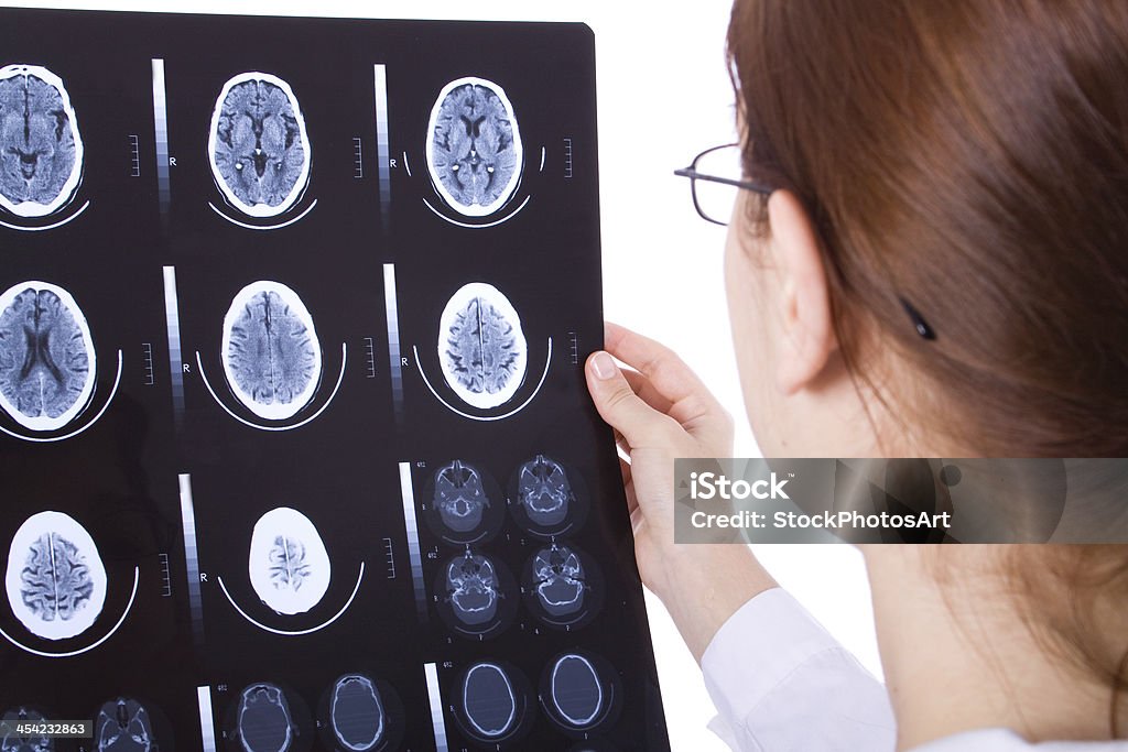 Feminino médico examinando um cérebro tomografia computadorizada - Foto de stock de Adulto royalty-free