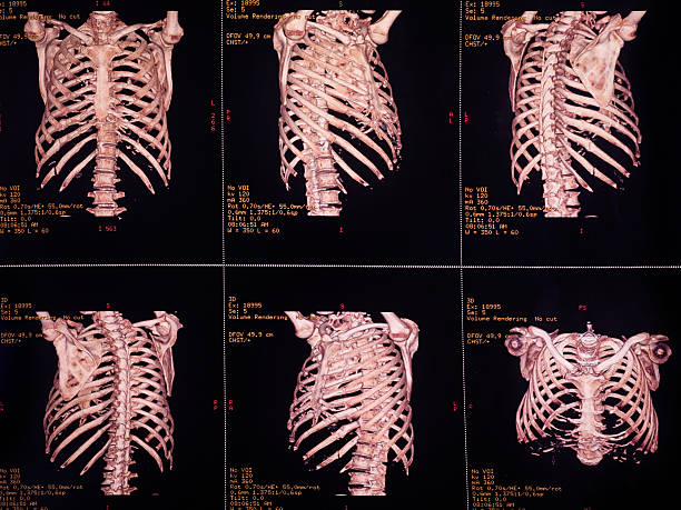 kardiale ct angiography und der brust - angio stock-fotos und bilder