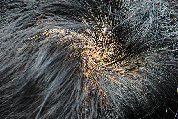 istock Human alopecia or hair loss problem  , shot from side view 454378963