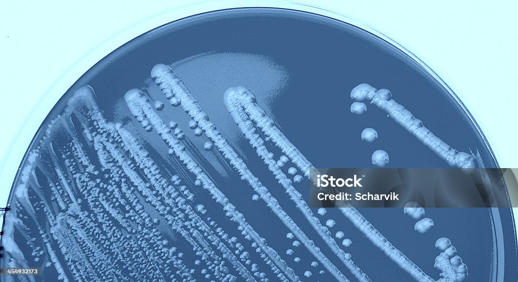 EHEC - Foto stock royalty-free di Escherichia coli