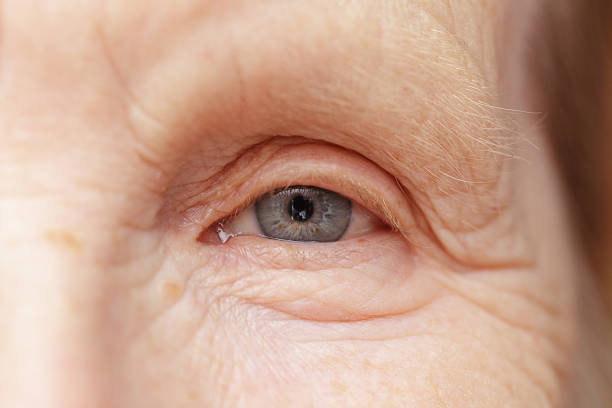 istock old woman gray eye 455290937