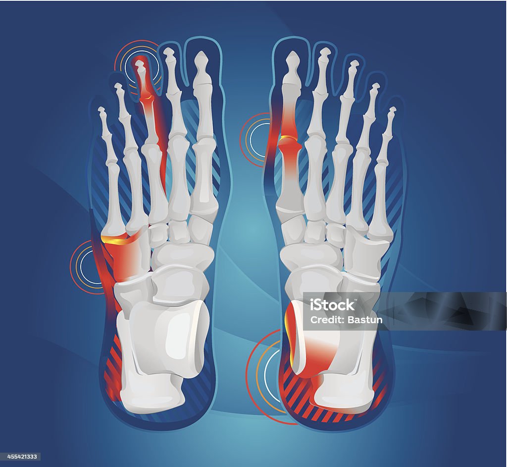 Foot bóle - Grafika wektorowa royalty-free (Anatomia człowieka)