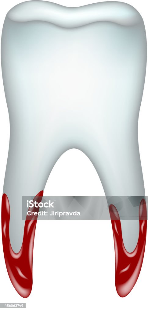 Dente desfiada com sangue - Vetor de Anatomia royalty-free