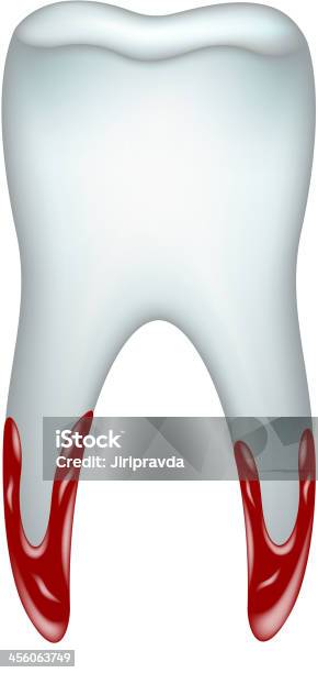 Vetores de Dente Desfiada Com Sangue e mais imagens de Anatomia - Anatomia, Apodrecer, Azul