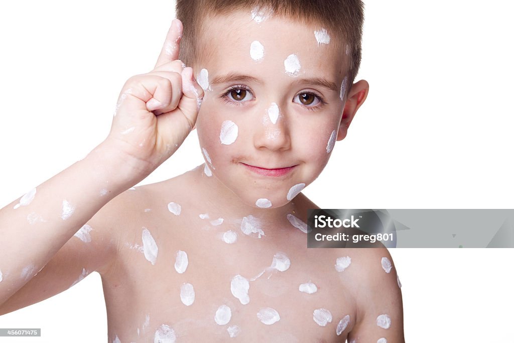 Boy with the Chickenpox's Moisturizer Stock Photo