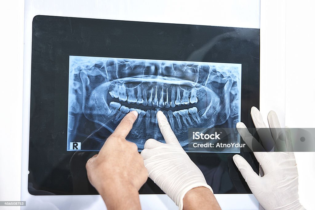 Untersuchen Zähne X-Ray - Lizenzfrei Asiatischer und Indischer Abstammung Stock-Foto