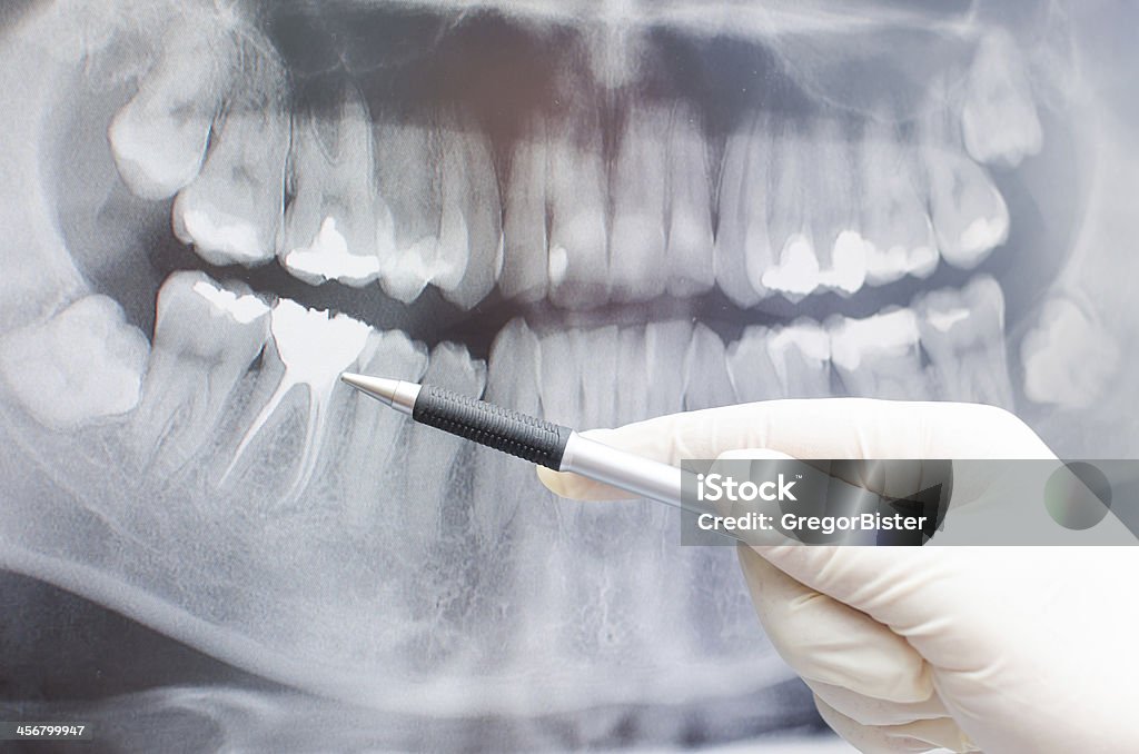 Dentist showing something on dental x-ray image Dentist showing something on dental x-ray image on computer monitor. Pen Stock Photo
