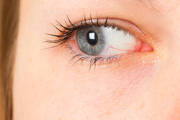 istock Women eye, close-up, blue, tear 457484715