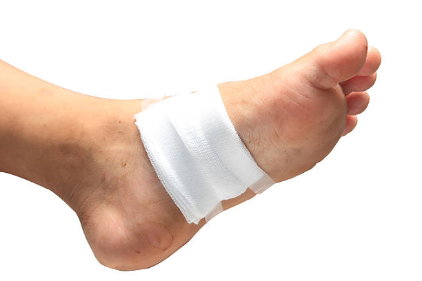 el tratamiento de pacientes con úlceras en los pies - gauze bandage adhesive bandage healthcare and medicine fotografías e imágenes de stock