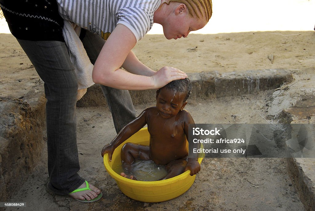 albino woman "Mwanza,Tanzania, February 8, 2010: Albino girl who washes a baby in the basin.Tanzania is the African region with more albinos. By the year 2006 albino people are killed for witchcraft rituals" Albino Stock Photo