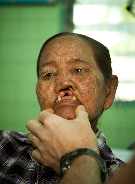 Senior Burmese woman being examined by a doctor stock photo