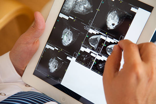 ipad를 사용하여 - digital tablet doctor note pad x ray image 뉴스 사진 이미지
