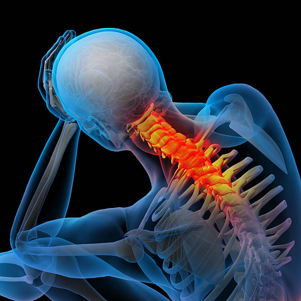 istock 3d rendered illustration - pain neck 458845553