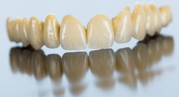 istock Porcelain dental bridge on mirror surface 459088465