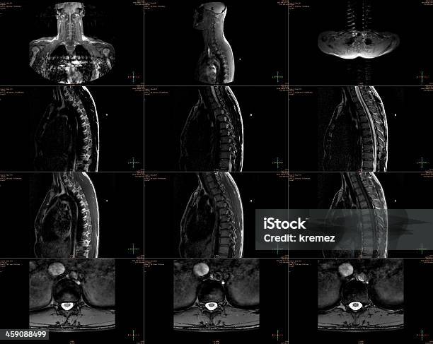 Mri Scan Stock Photo - Download Image Now - Abdomen, Animal Abdomen, Bladder