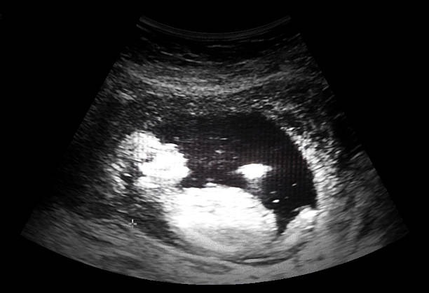 ultraschall-film - human pregnancy uterus abdomen man woman stock-fotos und bilder