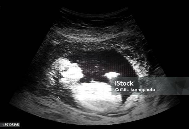 Ultrasound Film Stock Photo - Download Image Now - Ultrasound, Fetus, Pregnant