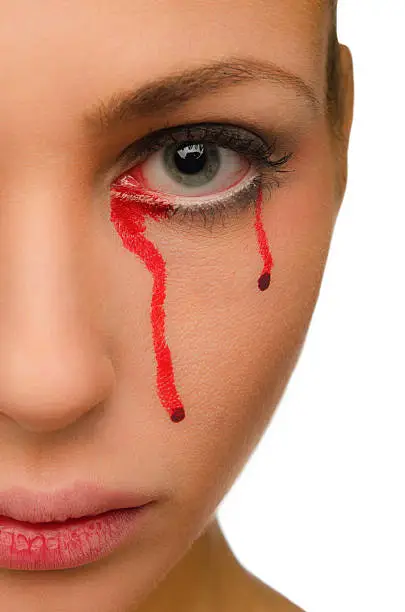 Photo of Of female eyes oozing blood