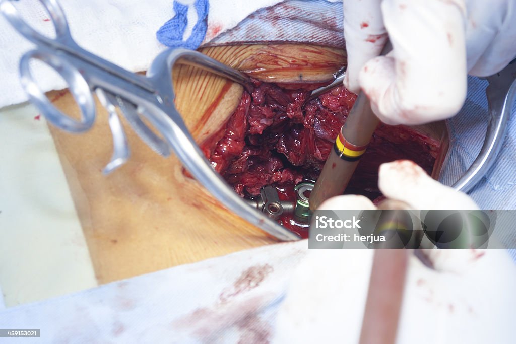 Surgical procedure Surgical procedure in the hospital Accidents and Disasters Stock Photo