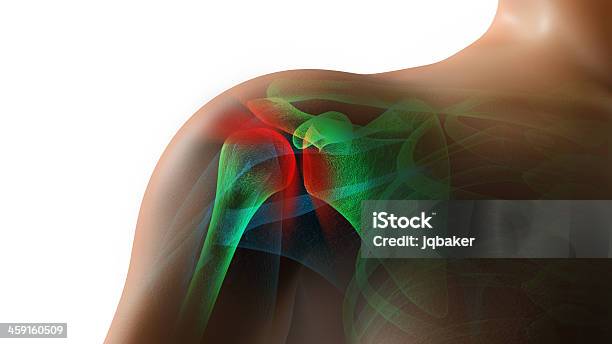 Lesioni Alla Spalla - Fotografie stock e altre immagini di Spalla - Giuntura - Spalla - Giuntura, Cuffia dei rotatori, Dolore fisico