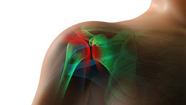 Shoulder Pain Injury High resolution 3D rendering of an injured shoulder in pain.  Composite image of x-ray includes clipping plane for background change. tissue anatomy stock pictures, royalty-free photos & images