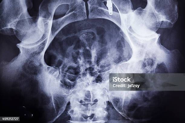 Полость Таза X Ray — стоковые фотографии и другие картинки Анатомия - Анатомия, Бедренная кость, Белый