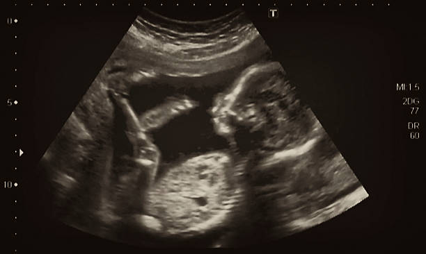 ultrasonography analyse der vierten monat alter fötus - babies only audio stock-fotos und bilder