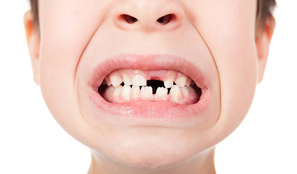 istock Boy portrait with a lost tooth 459393329