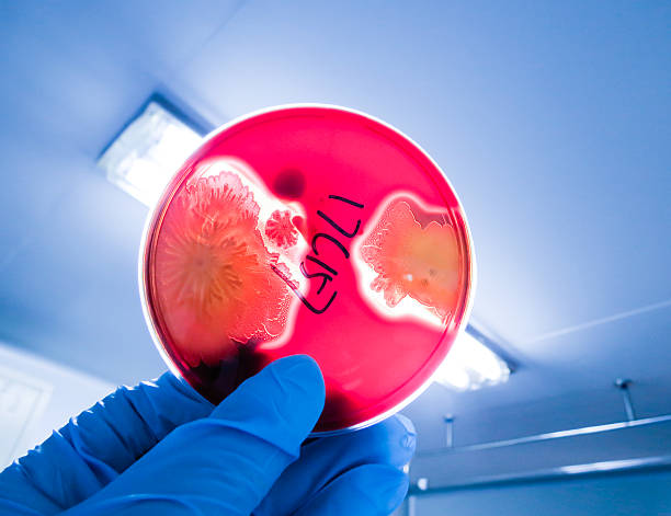 Investigador ver hemolítica bactérias em placas - fotografia de stock