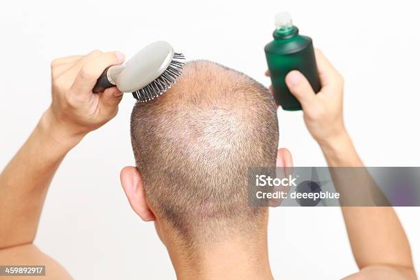 Hair Restorer Stock Photo - Download Image Now - Hair Tonic, Adult, Back Of Head