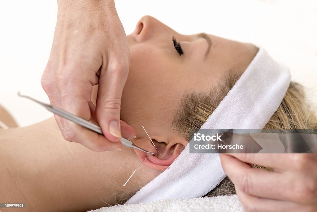 Alternative practitioner treating woman with acupuncture. Alternative practitioner treating woman with acupuncture. Homeopath treating woman with ear acupuncture techniques, also known as auriculotherapy by using needles and pressure points Auriculotherapy Stock Photo