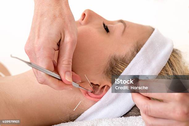 Alternative Practitioner Treating Woman With Acupuncture Stock Photo - Download Image Now