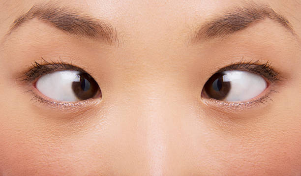 istock Cross Eyes Young Woman 460454011