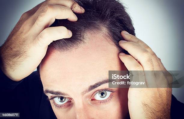 Man Controls Hair Loss Stock Photo - Download Image Now - Hair Loss, Men, Examining