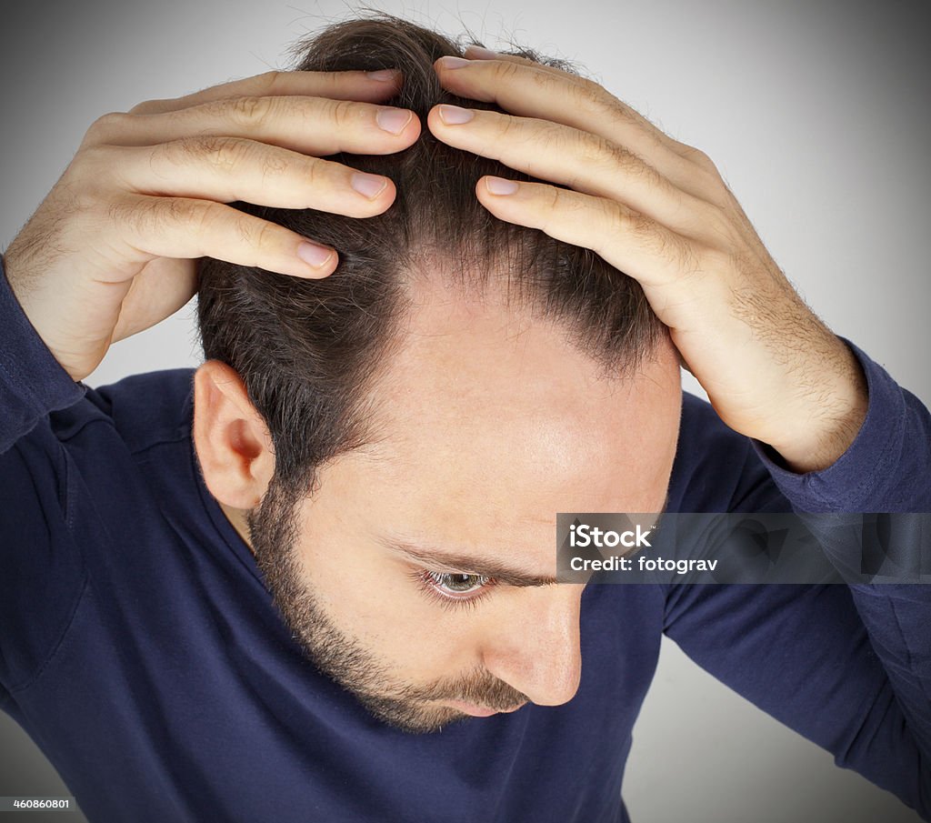 Man controls hair loss Caucasian young man controls hair loss Hair Loss Stock Photo