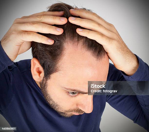 Man Controls Hair Loss Stock Photo - Download Image Now - Hair Loss, Men, Adult