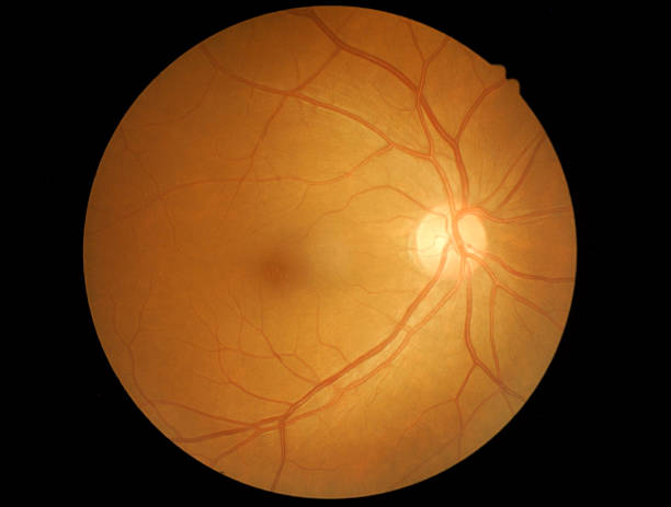 medical foto dettagli della retina dell'occhio umano - nuerotic foto e immagini stock