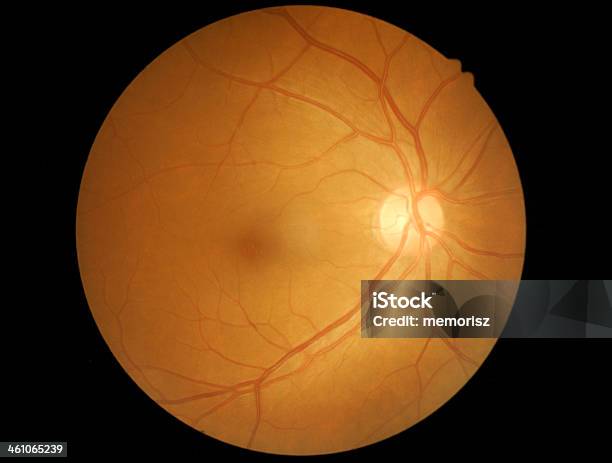 Medical Photo Detailing The Retina Human Eye Stock Photo - Download Image Now - Diabetic Retinopathy, Adult, Anticipation