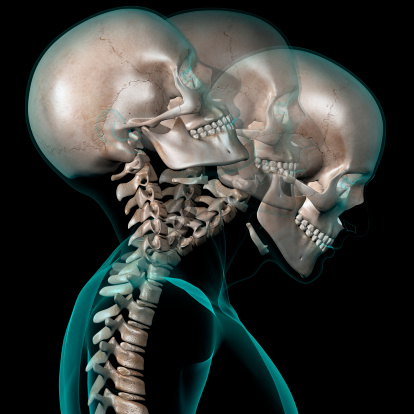 X-ray of a human head showing a example of contortion: the neck bending back and forward. Side view, isolated on black background.